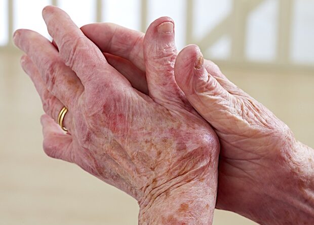 Arthritis medication can reverse the lung damage of COVID